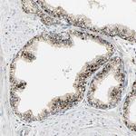 ASAH1 Antibody in Immunohistochemistry (IHC)