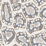 ASAH1 Antibody in Immunohistochemistry (IHC)