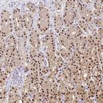 Annexin A10 Antibody in Immunohistochemistry (IHC)