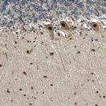 PSMC4 Polyclonal Antibody