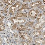 GYG2 Polyclonal Antibody