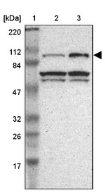 Gemin 3 Antibody in Western Blot (WB)