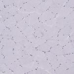 Gemin 3 Antibody in Immunohistochemistry (IHC)