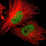 ZNF701 Polyclonal Antibody