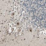 ZNF701 Antibody in Immunohistochemistry (Paraffin) (IHC (P))