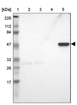 ZNF701 Antibody in Western Blot (WB)