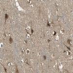 KANK1 Polyclonal Antibody