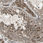 ZNF608 Antibody in Immunohistochemistry (Paraffin) (IHC (P))