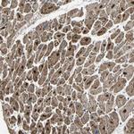 ZNF608 Antibody in Immunohistochemistry (Paraffin) (IHC (P))