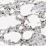 ZNF608 Antibody in Immunohistochemistry (Paraffin) (IHC (P))