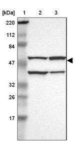 CECR5 Antibody in Western Blot (WB)