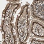 Cyclin T2 Antibody in Immunohistochemistry (Paraffin) (IHC (P))