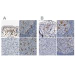 SKAP2 Antibody in Immunohistochemistry (IHC)