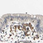 SKAP2 Antibody in Immunohistochemistry (IHC)