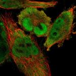 CDCA7 Antibody in Immunocytochemistry (ICC/IF)