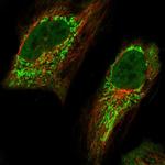 AMT Polyclonal Antibody