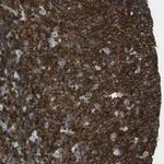 APBB3 Antibody in Immunohistochemistry (Paraffin) (IHC (P))