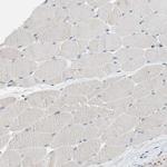 PCSK4 Antibody in Immunohistochemistry (Paraffin) (IHC (P))