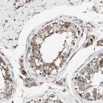 PCSK4 Antibody in Immunohistochemistry (Paraffin) (IHC (P))