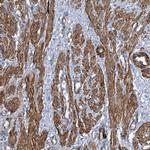 ZNF490 Polyclonal Antibody