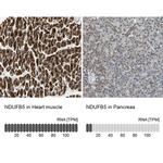 NDUFB5 Antibody in Immunohistochemistry (IHC)