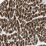 NDUFB5 Antibody in Immunohistochemistry (IHC)