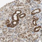 NDUFB5 Antibody in Immunohistochemistry (IHC)