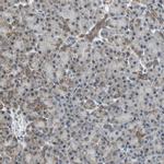 NDUFB5 Antibody in Immunohistochemistry (IHC)