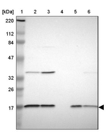 NDUFB5 Antibody in Western Blot (WB)
