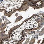 DIAPH2 Antibody in Immunohistochemistry (IHC)