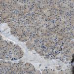 DIAPH2 Antibody in Immunohistochemistry (IHC)