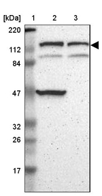 DIAPH2 Antibody in Western Blot (WB)
