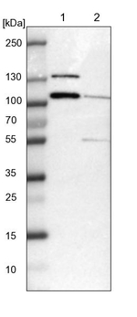 DIAPH2 Antibody in Western Blot (WB)