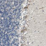 TM9SF2 Antibody in Immunohistochemistry (IHC)