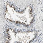 TM9SF2 Antibody in Immunohistochemistry (IHC)