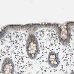 TM9SF2 Antibody in Immunohistochemistry (IHC)