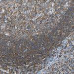 SEPT6 Polyclonal Antibody