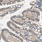 SEPT6 Antibody in Immunohistochemistry (Paraffin) (IHC (P))