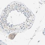 SEPT6 Antibody in Immunohistochemistry (Paraffin) (IHC (P))