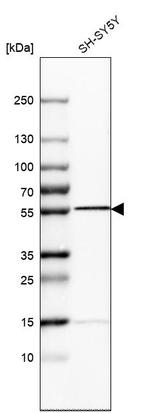 SEPT6 Antibody in Western Blot (WB)