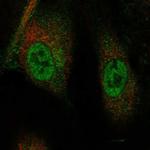 TRIM21 Polyclonal Antibody