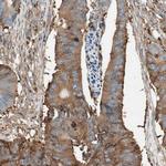 ITGBL1 Antibody in Immunohistochemistry (IHC)