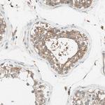 ITGBL1 Polyclonal Antibody