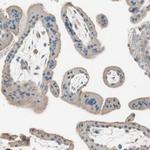 ITGBL1 Antibody in Immunohistochemistry (IHC)