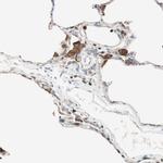 ITGBL1 Antibody in Immunohistochemistry (IHC)