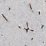 RIOK2 Antibody in Immunohistochemistry (Paraffin) (IHC (P))