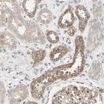 RIOK2 Antibody in Immunohistochemistry (Paraffin) (IHC (P))