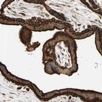RIOK2 Antibody in Immunohistochemistry (Paraffin) (IHC (P))