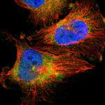 QSER1 Polyclonal Antibody