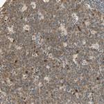 QSER1 Antibody in Immunohistochemistry (Paraffin) (IHC (P))